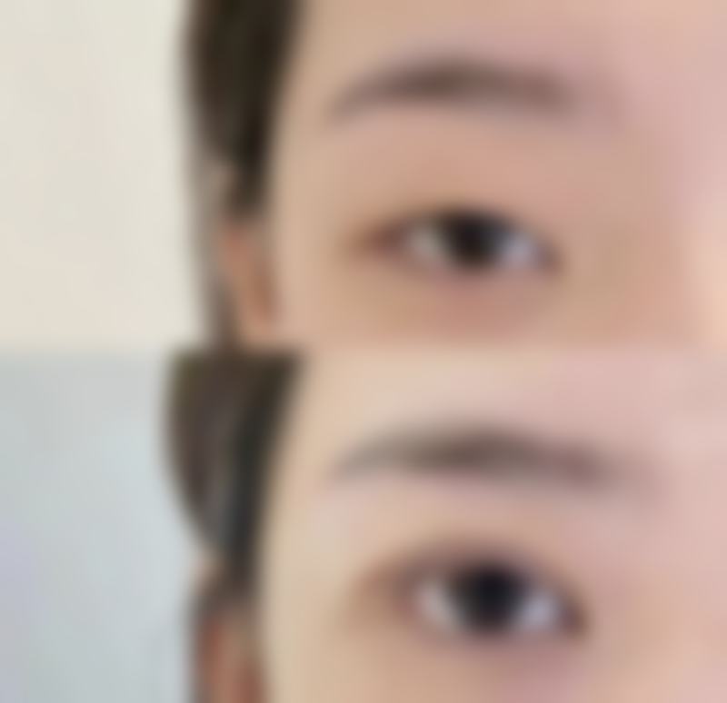 罗荣新医生擅长的特色与常规医美项目