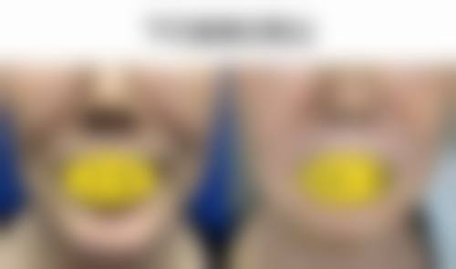 北京艾玛整形医疗美容诊所求美者反馈