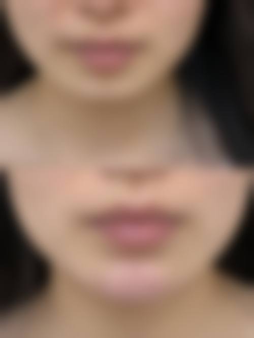 石家庄斯特恩医疗美容医院求美者反馈