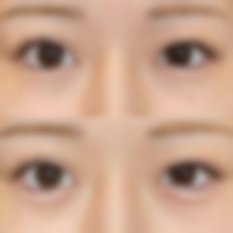 韩国优雅人整形医院价格收费