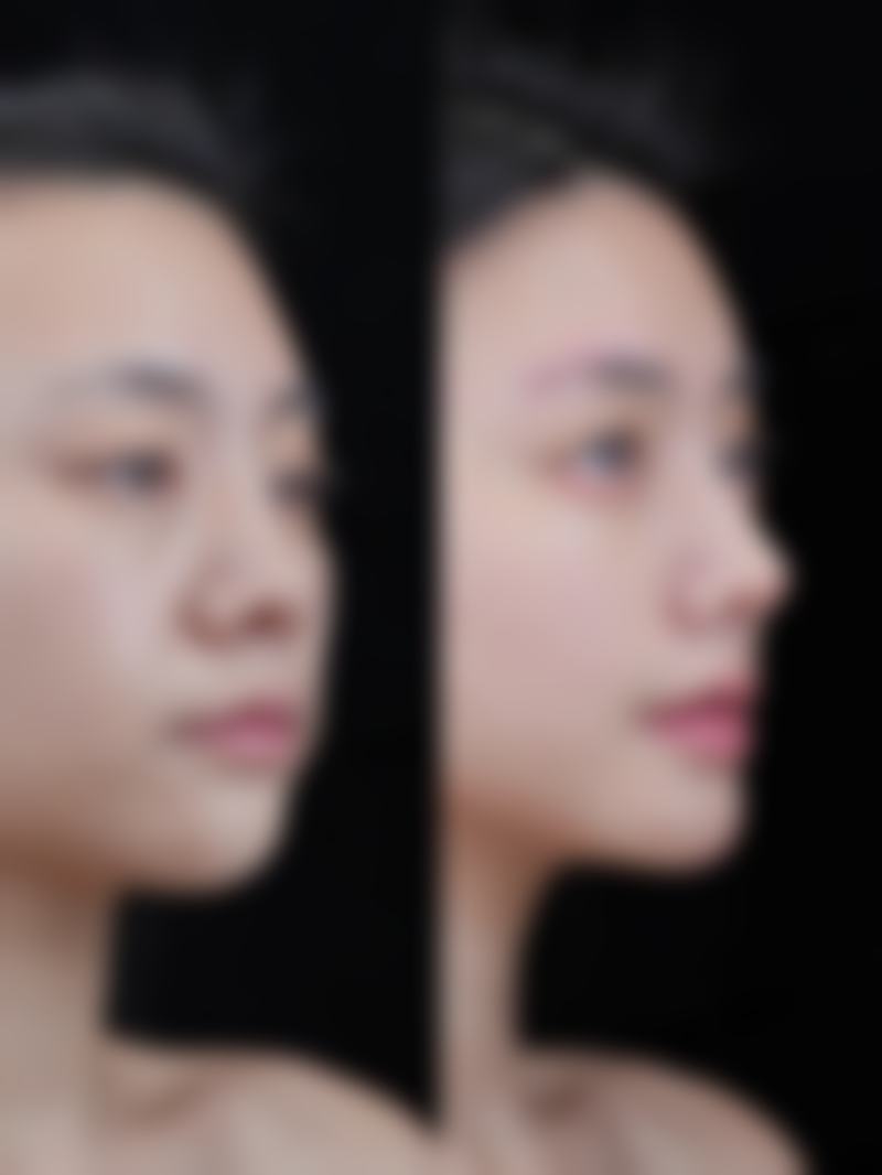 韩国优雅人整形医院医生团队实力