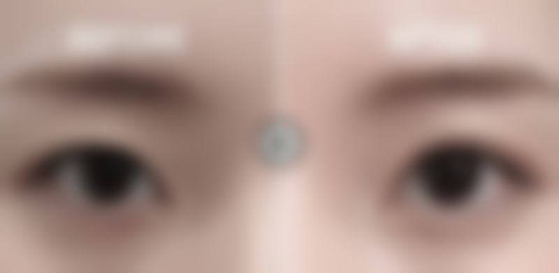 预约金度焰院长面诊的方式