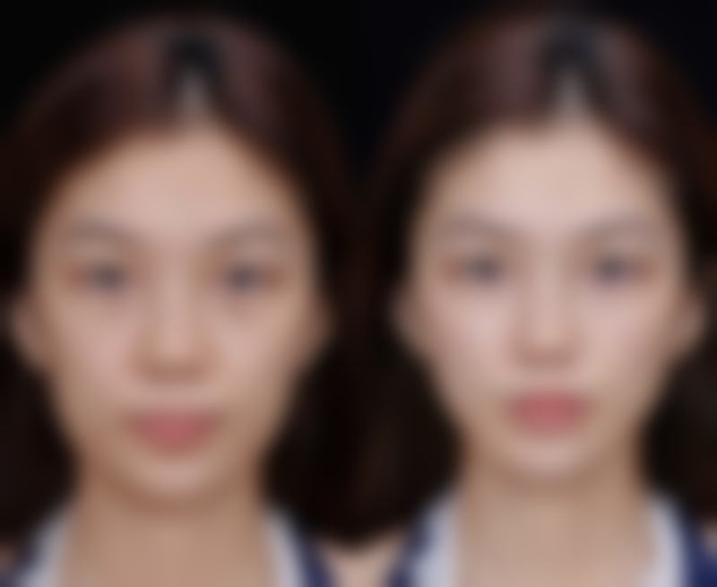 昆明时光整形医疗美容门诊部价格收费