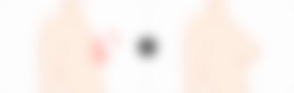 韩国MD整形医院