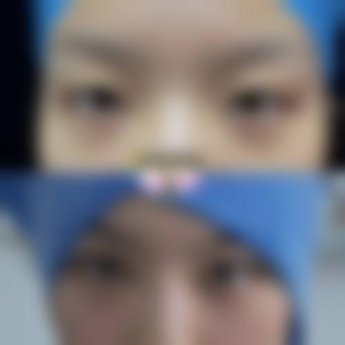 西安微美小颜医疗美容诊所价格收费