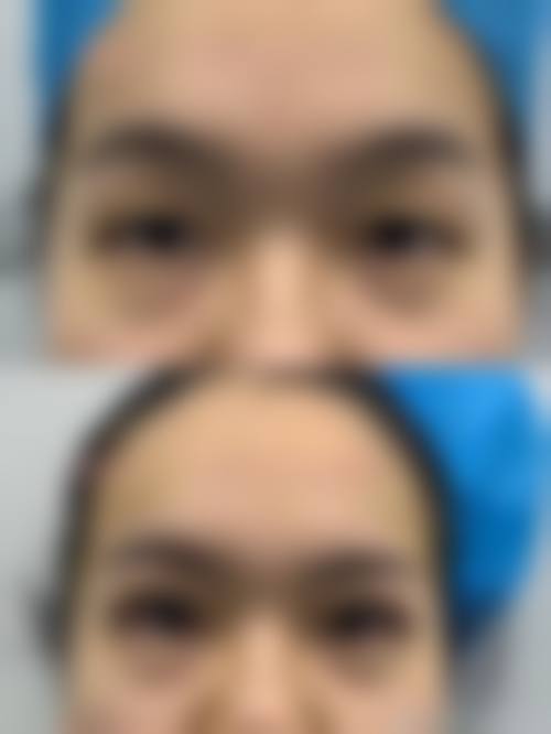 台州椒江李晓燕诊所求美者反馈