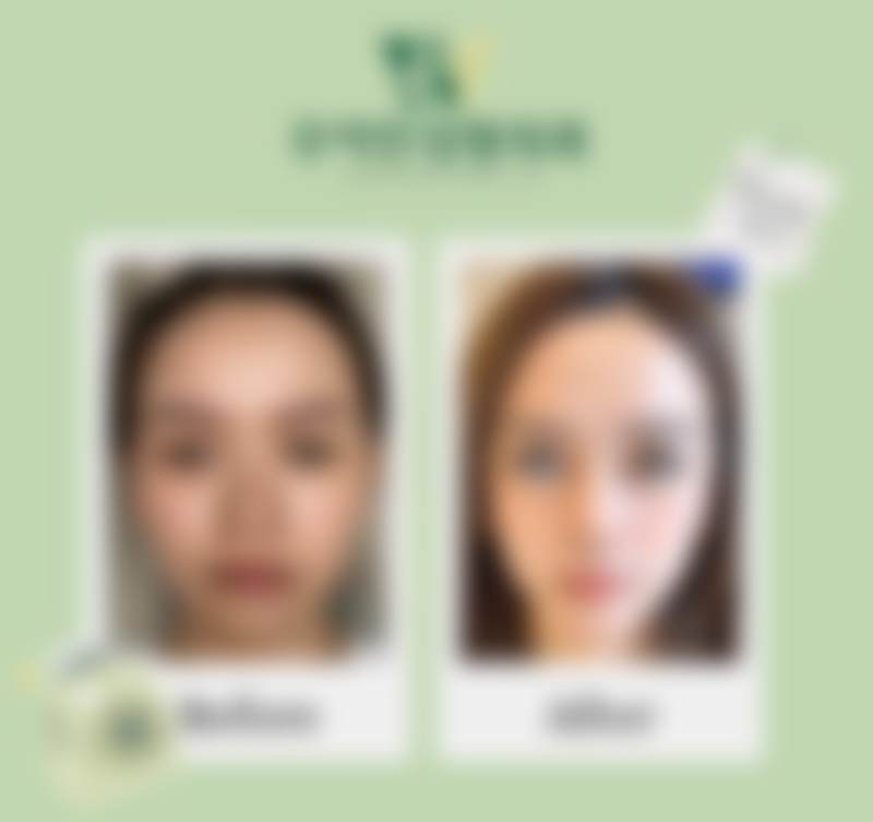 朴哲佑院长的就诊渠道与医院保护