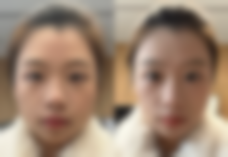 池州市丽美整形外科门诊部求美者反馈