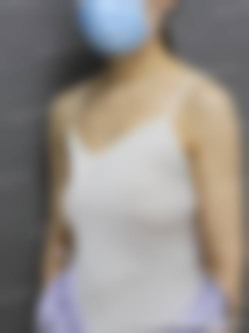 成都颜闺蜜医疗美容诊所求美者反馈