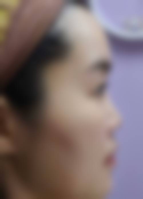 周李燕医师的鼻部整形特色项目及参考价格