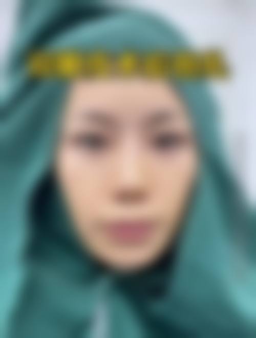 南京维秀医疗美容诊所价格收费