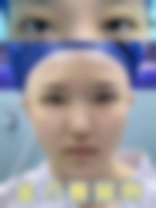 台州天南医疗美容诊所求美者反馈