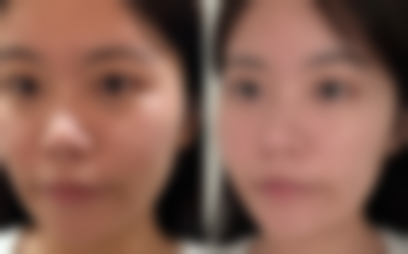 黄世挥医生就诊的硬件保护：精良医美设备与专属环境