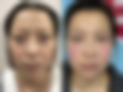 长沙美臣铂宫整形医疗美容医院特色项目及技术优势