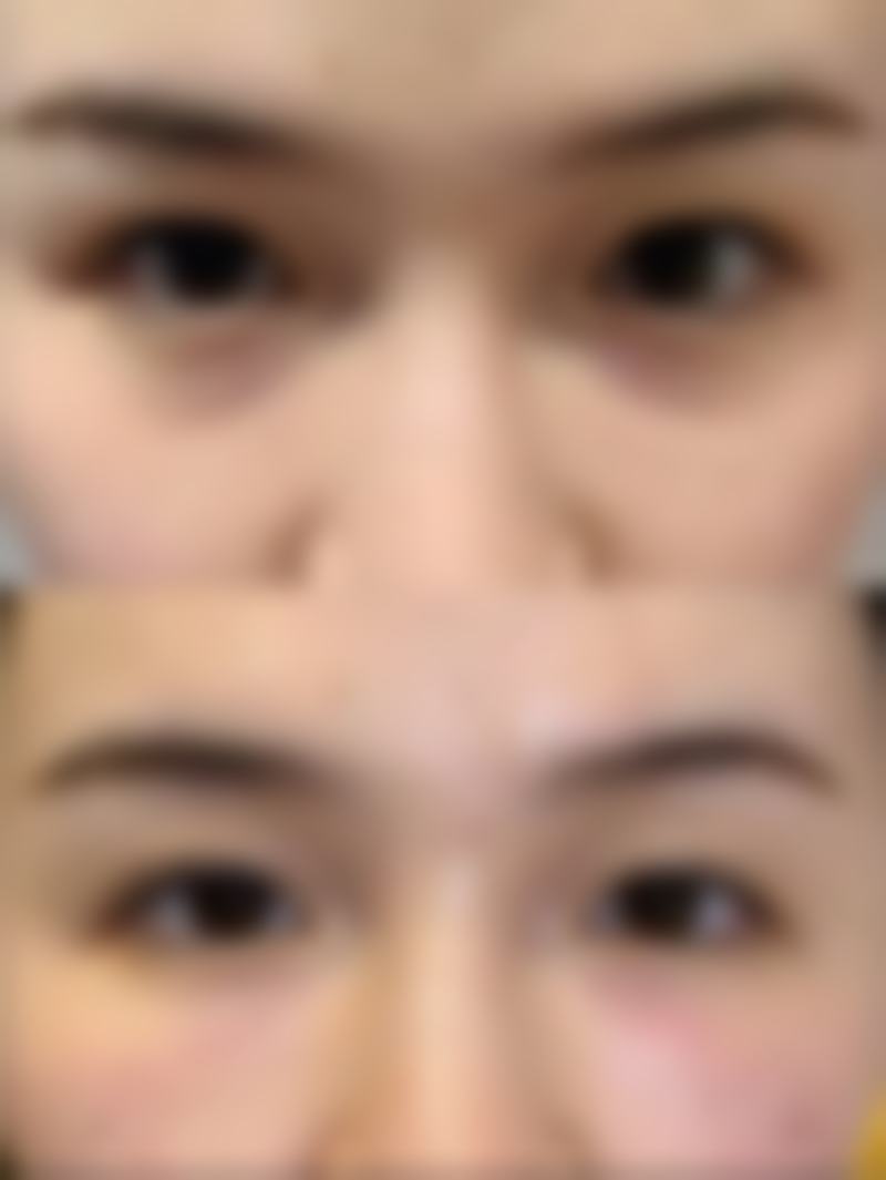 邯郸雅乾医疗美容医院求美者反馈