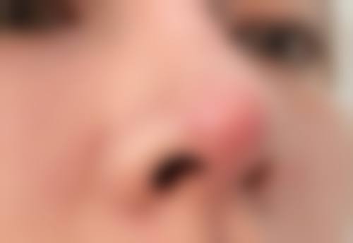 苏州吴中维多利亚美容整形医院价格收费