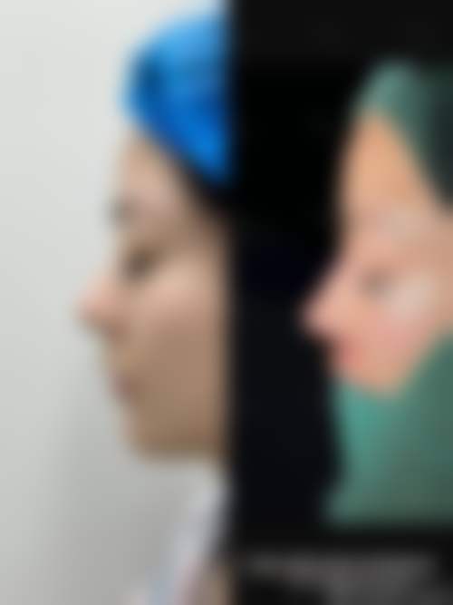 何英杰医生覆盖全品类的医美擅长项目