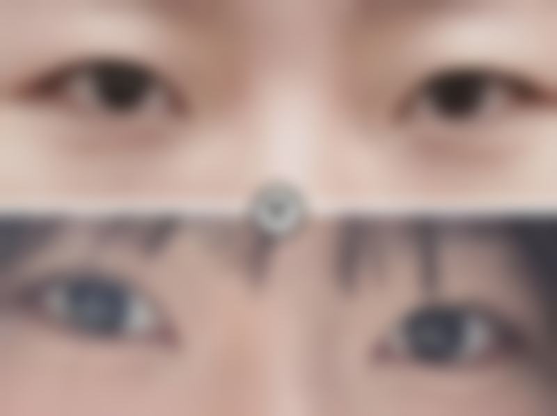 成都瑞丽诗美学植发整形门诊部价格收费