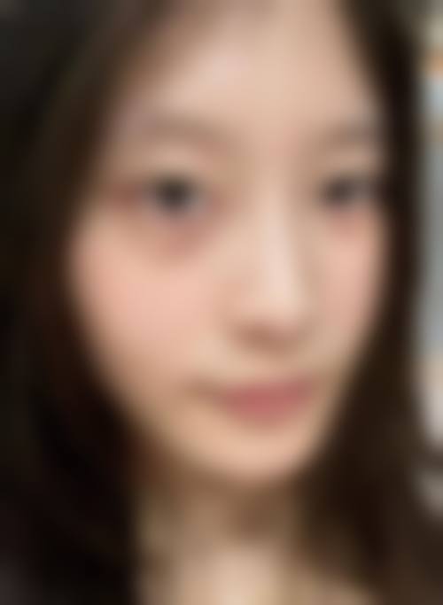 呼和浩特王成毅整形医疗美容诊所价格收费