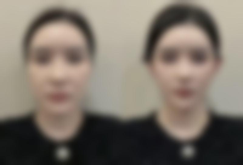 上海一美整形外科医院求美者反馈