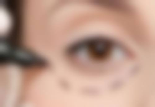 日本百人町阿尔法整形诊所特色项目及技术优势