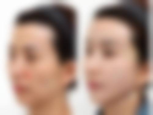 成都菲诺瑞妍医疗美容门诊部来院路线