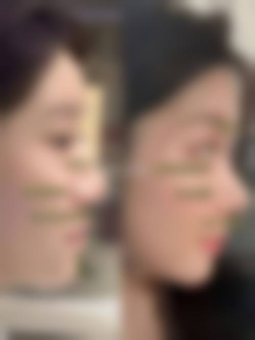 河南洛阳孔繁荣医疗美容门诊部价格收费