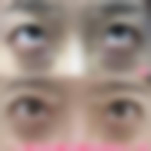 日本百人町阿尔法整形诊所价格收费