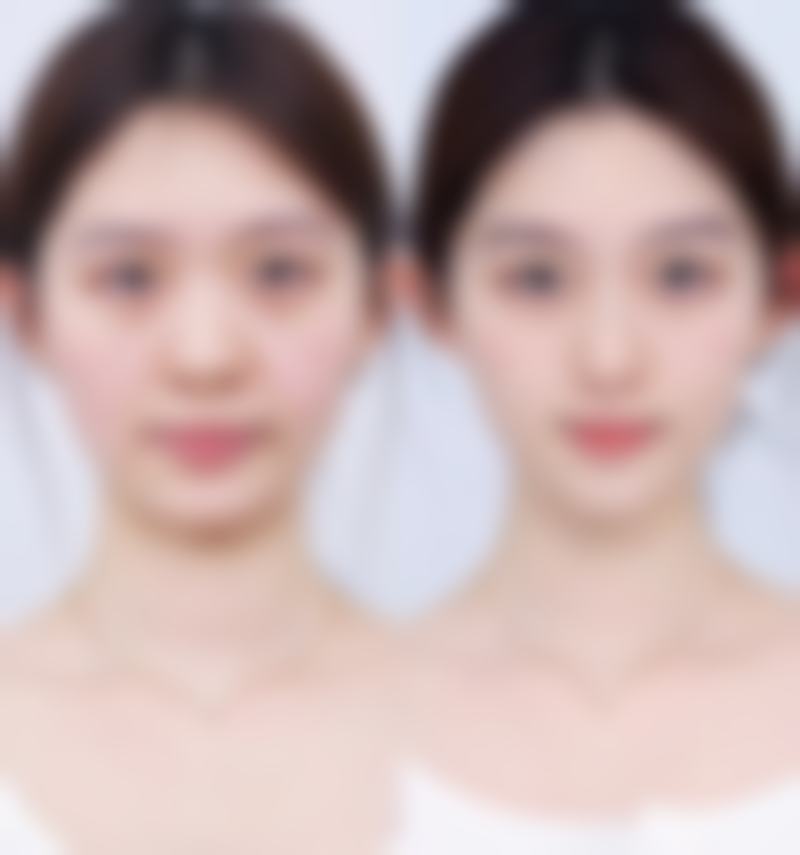 韩国TheBidan德碧亶整形外科特色项目及技术优势