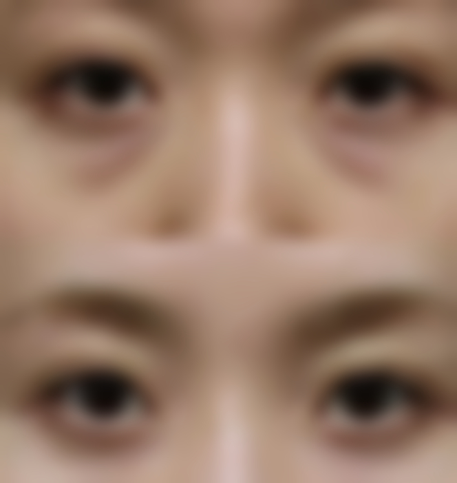 韩国TheBidan德碧亶整形外科价格收费