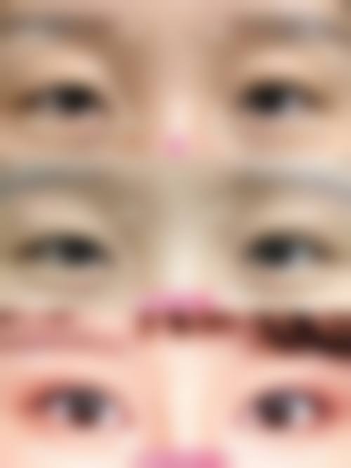 宜宾爱迪眼耳鼻喉医院求美者反馈