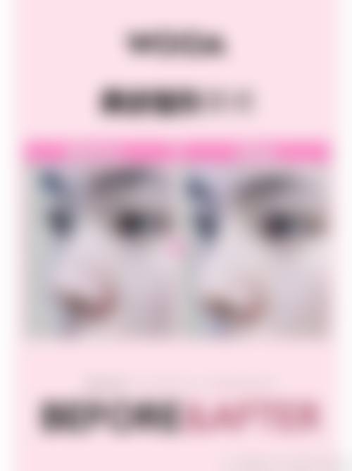 成都美雅娜整形医院特色项目及技术优势