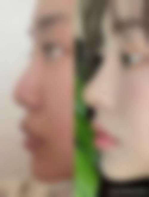 成都美雅娜整形医院求美者反馈