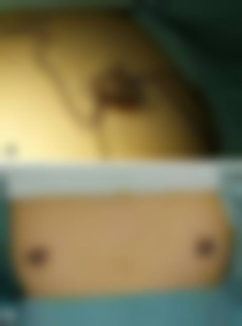 承德亨川整形医院求美者反馈