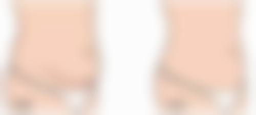 武威韩奈姿整形医院价格收费
