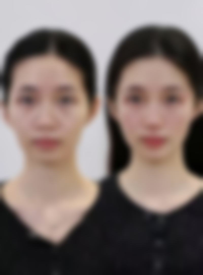 株洲美妍荟医疗美容诊所特色项目及技术优势