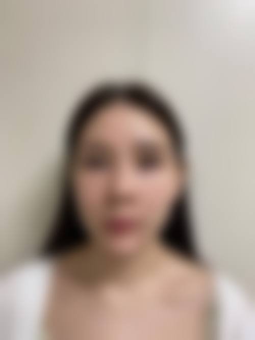 贵阳观山湖妮斯医疗美容门诊部求美者反馈
