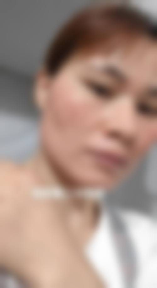 涂成芳医师坚持的个性化医美理念