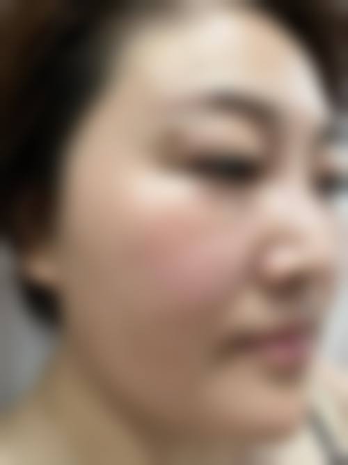 牛军州医生坚持