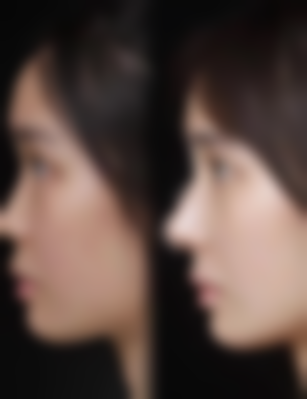 云南华美美莱美容医院有限公司价格收费