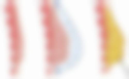 温州科发源植发医院特色项目及技术优势
