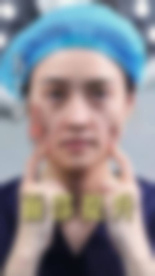 湖州熹颜医疗美容诊所求美者反馈