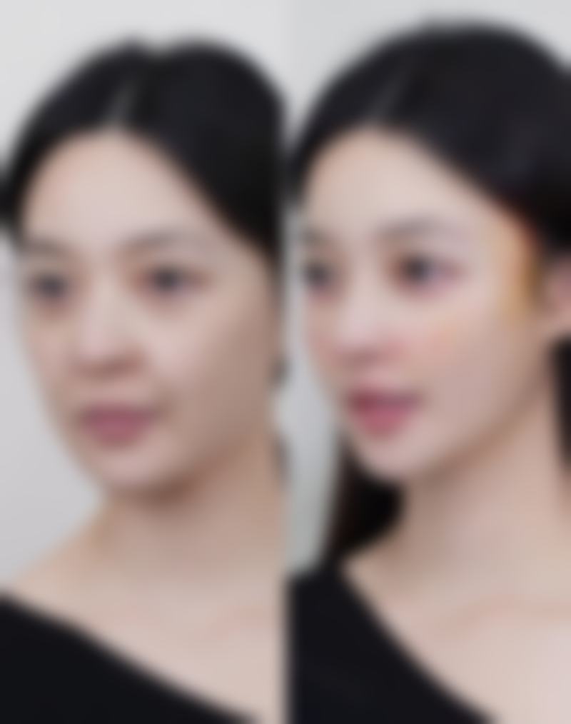 韩国H白汀桓整形外科医院求美者反馈