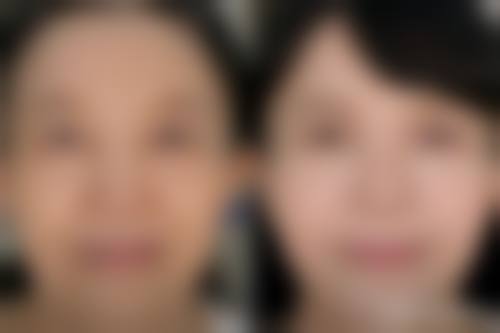 韩国JH整形医院特色项目及技术优势