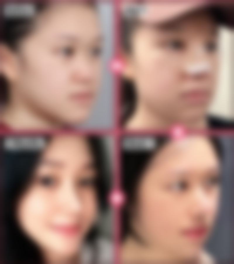 长春正韩整形美容门诊部求美者反馈