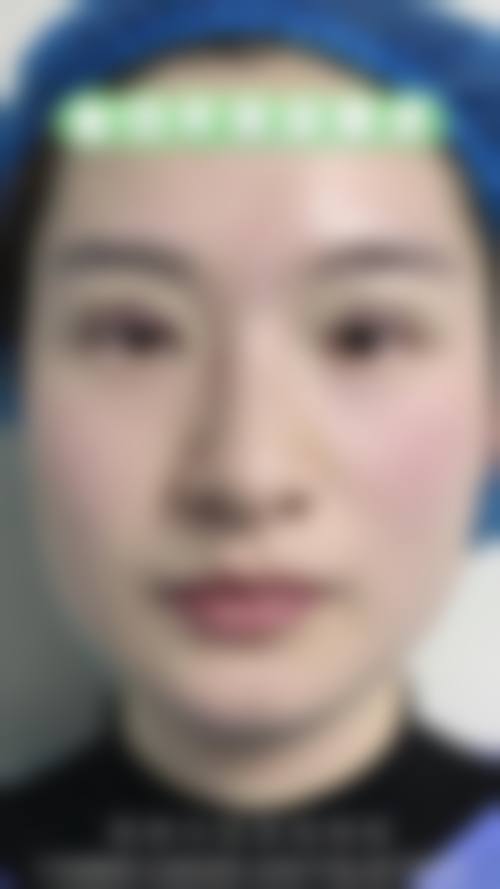 安康市人民医院求美者反馈