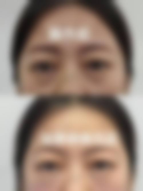 广州眼黛医疗美容诊所价格收费
