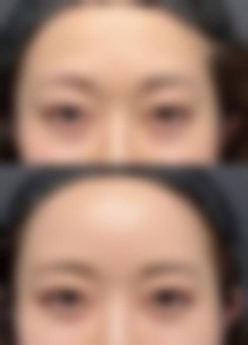 广州眼黛医疗美容诊所特色项目及技术优势