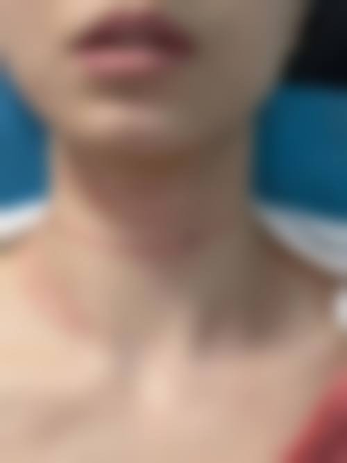 张玉华医生的诊疗服务理念
