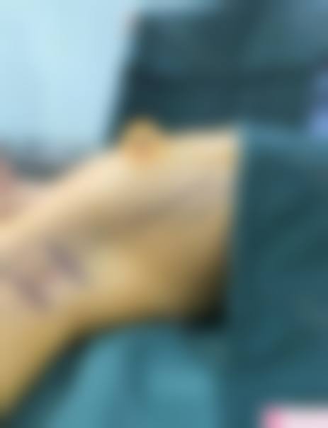 亳州永美整形医院求美者反馈